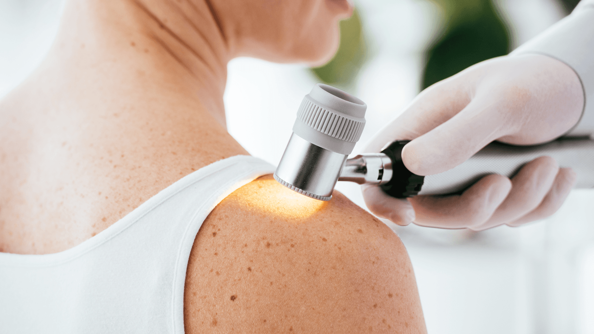 Дерматологическая консультация в Бельцах. Дерматолог Бельцы